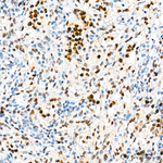 Transketolase Antibody in Immunohistochemistry (Paraffin) (IHC (P))
