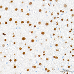Transketolase Antibody in Immunohistochemistry (Paraffin) (IHC (P))