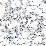 Transketolase Antibody in Immunohistochemistry (Paraffin) (IHC (P))