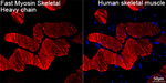 MYH1 Antibody in Immunohistochemistry (Paraffin) (IHC (P))