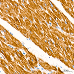 MYH1 Antibody in Immunohistochemistry (Paraffin) (IHC (P))