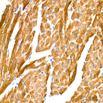 MYH1 Antibody in Immunohistochemistry (Paraffin) (IHC (P))