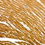 MYH1 Antibody in Immunohistochemistry (Paraffin) (IHC (P))