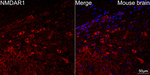 NMDAR1 Antibody in Immunohistochemistry (Paraffin) (IHC (P))