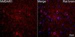 NMDAR1 Antibody in Immunohistochemistry (Paraffin) (IHC (P))