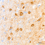 NMDAR1 Antibody in Immunohistochemistry (Paraffin) (IHC (P))
