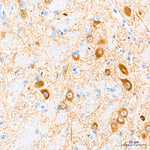 NMDAR1 Antibody in Immunohistochemistry (Paraffin) (IHC (P))