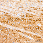 NMDAR1 Antibody in Immunohistochemistry (Paraffin) (IHC (P))