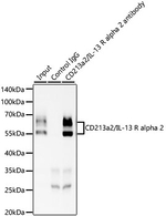 IL13RA2 Antibody in Immunoprecipitation (IP)