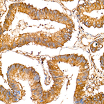 LAP3 Recombinant Rabbit Monoclonal Antibody (10B6E1)