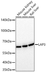 LAP3 Antibody in Western Blot (WB)