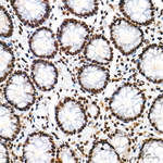 hnRNP A2B1 Antibody in Immunohistochemistry (Paraffin) (IHC (P))