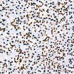 hnRNP A2B1 Antibody in Immunohistochemistry (Paraffin) (IHC (P))