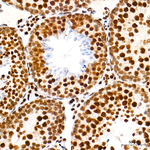 hnRNP A2B1 Antibody in Immunohistochemistry (Paraffin) (IHC (P))