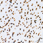 hnRNP A2B1 Antibody in Immunohistochemistry (Paraffin) (IHC (P))