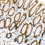 hnRNP A2B1 Antibody in Immunohistochemistry (Paraffin) (IHC (P))