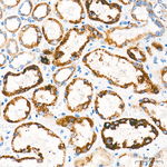 OAT Antibody in Immunohistochemistry (Paraffin) (IHC (P))