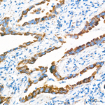 OAT Antibody in Immunohistochemistry (Paraffin) (IHC (P))