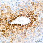 OAT Antibody in Immunohistochemistry (Paraffin) (IHC (P))
