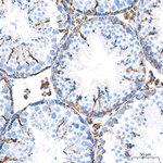 OAT Antibody in Immunohistochemistry (Paraffin) (IHC (P))