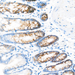 OAT Antibody in Immunohistochemistry (Paraffin) (IHC (P))