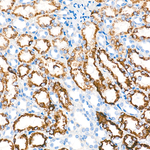 OAT Antibody in Immunohistochemistry (Paraffin) (IHC (P))