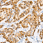 CHCHD4 Antibody in Immunohistochemistry (Paraffin) (IHC (P))