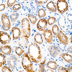 CHCHD4 Antibody in Immunohistochemistry (Paraffin) (IHC (P))