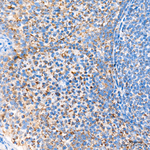 CHCHD4 Antibody in Immunohistochemistry (Paraffin) (IHC (P))