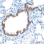 CHCHD4 Antibody in Immunohistochemistry (Paraffin) (IHC (P))