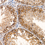 CHCHD4 Antibody in Immunohistochemistry (Paraffin) (IHC (P))