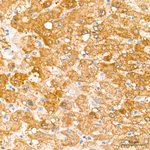 MECR Antibody in Immunohistochemistry (Paraffin) (IHC (P))