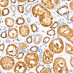 MECR Antibody in Immunohistochemistry (Paraffin) (IHC (P))