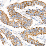 MECR Recombinant Rabbit Monoclonal Antibody (4F2U4)