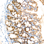 MECR Antibody in Immunohistochemistry (Paraffin) (IHC (P))