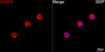 FABP5 Antibody in Immunocytochemistry (ICC/IF)