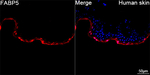 FABP5 Antibody in Immunohistochemistry (Paraffin) (IHC (P))