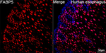 FABP5 Antibody in Immunohistochemistry (Paraffin) (IHC (P))