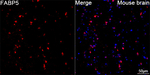 FABP5 Antibody in Immunohistochemistry (Paraffin) (IHC (P))