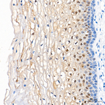 FABP5 Antibody in Immunohistochemistry (Paraffin) (IHC (P))