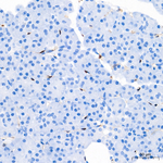 FABP5 Antibody in Immunohistochemistry (Paraffin) (IHC (P))