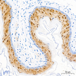 FABP5 Antibody in Immunohistochemistry (Paraffin) (IHC (P))
