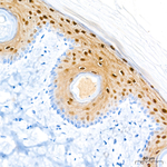 FABP5 Antibody in Immunohistochemistry (Paraffin) (IHC (P))