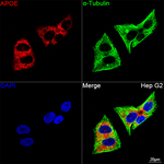 APOE Recombinant Rabbit Monoclonal Antibody (5I4Q2)