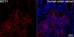 MCT1 Antibody in Immunohistochemistry (Paraffin) (IHC (P))