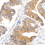 MCT1 Antibody in Immunohistochemistry (Paraffin) (IHC (P))