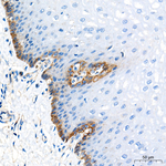 MCT1 Antibody in Immunohistochemistry (Paraffin) (IHC (P))