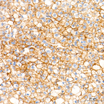 MCT1 Antibody in Immunohistochemistry (Paraffin) (IHC (P))