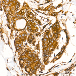 IRF3 Antibody in Immunohistochemistry (Paraffin) (IHC (P))