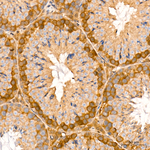 IRF3 Antibody in Immunohistochemistry (Paraffin) (IHC (P))